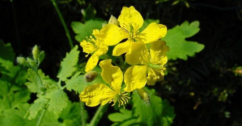 celandine for psoriasis on the hands
