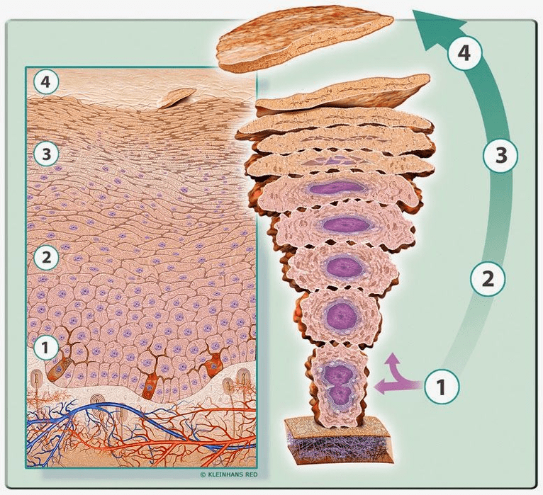 cell keratinization in psoriasis