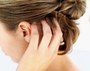psoriasis in the head