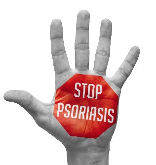 The prevention of psoriasis