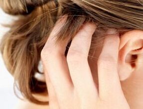 signs and symptoms of psoriasis on the scalp